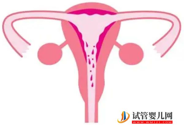 XY孕囊和XX孕囊形狀各有差異，橢圓形可能是懷女哦！(圖3)
