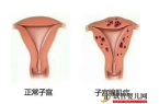 初次性生活要注意什么？女人第一次恐懼做愛怕疼怎