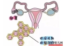 注意男性下體太敏感的原因 了解誘因揚長避短 